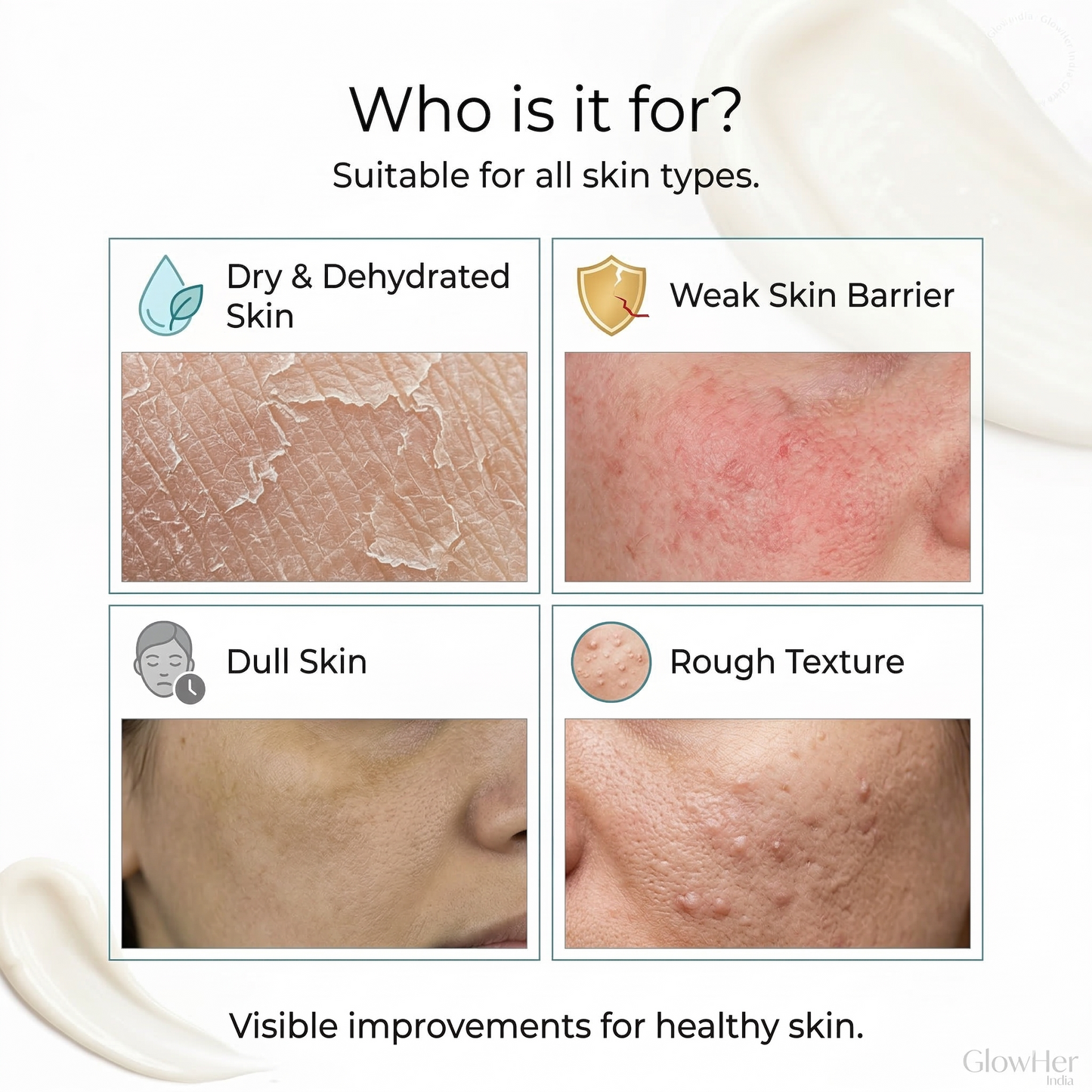 Winter Barrier Moisturizer Cream